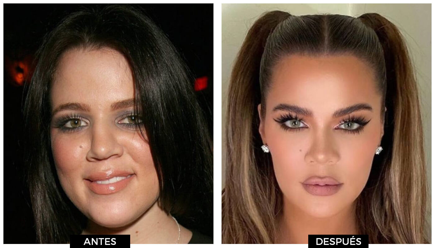 antes y después Foxy Eyes de Khloe Kardashian